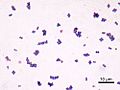 Staphylococcus aureus Gram