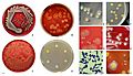 Staphylococcus aureus appearance on agar plates