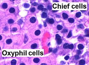 Parathyroid oxyphil and chief cells - annotated