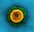 Novel Coronavirus SARS-CoV-2 (50960620707) (cropped)
