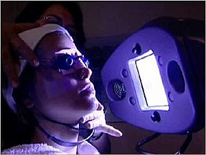 Blue Light acne phototherapy iClear