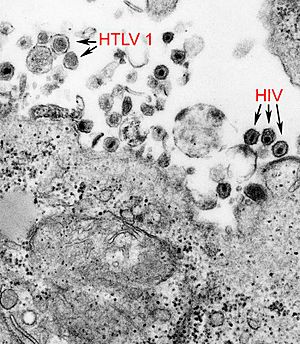 HTLV-1 and HIV-1 EM 8241 lores