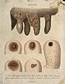 A cow's udder with vaccinia pustules and human arms exhibiti Wellcome V0016678