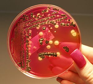 Salmonella growing on XLD agar
