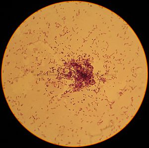 Lactococcus lactis.jpg