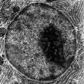 Micrograph of a cell nucleus
