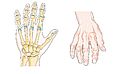 Osteoarthritis -- Smart-Servier (cropped)