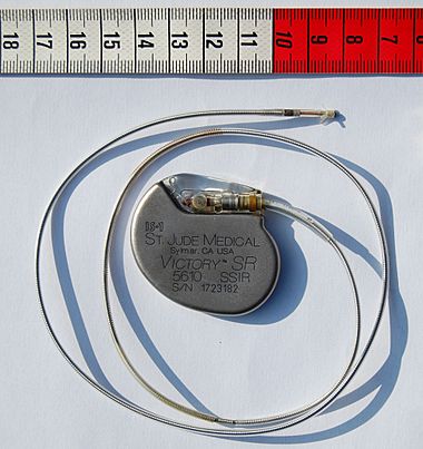 St Jude Medical pacemaker with ruler.jpg
