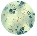 Streptococcus pyogenes 01