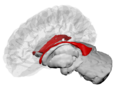 Lateral Ventricles - DK ATLAS