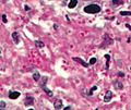 Histoplasma pas-d small