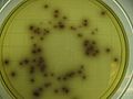 Listeria monocytogenes grown on Listeria Selective Agar