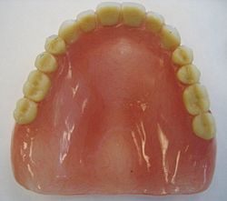 Occclusal denture example