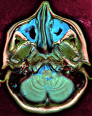 Brain MRI 112010 rgbca