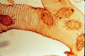 Tracheal mite - Acarapis woodi.jpg