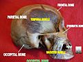 Occipital bone 2