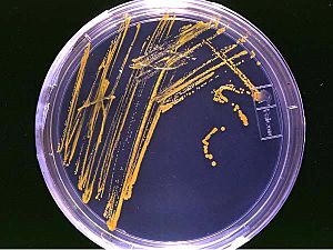 Agar plate with colonies