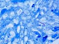 Mycobacterium tuberculosis Ziehl-Neelsen stain 640