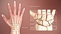 3D Medical Animation Human Wrist