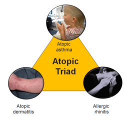 Atopic triad 2.PNG