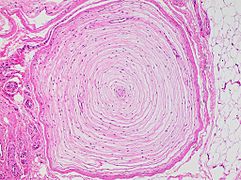 Histology of a Pacinian corpuscle