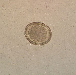 Ascaris lumbricoides4