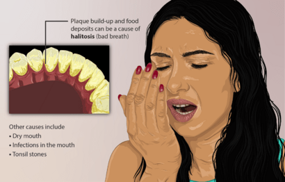 Depiction of a person who has Halitosis (or bad breath).png