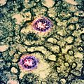 Novel Coronavirus SARS-CoV-2 (Omicron) (52228029552)
