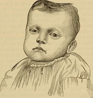An American text-book of the diseases of children (1895) (14782023652)