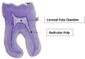 SDEO- Dental Pulp