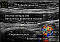 Ultrasonography of a normal appendix, annotated
