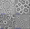 Four common forms of Blastocystis hominis Valzn