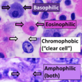 Eosinophilic, basophilic, chromophobic and amphophilic staining