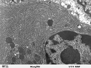 Clara cell lung - TEM