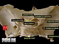 Sphenoid bone - superior view