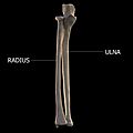 Radius and Ulna - Forearm Bones