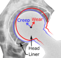 Hip prosthesis liner creep and wear