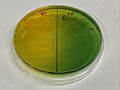 TCBS agar plate of Vibrio Cholerae and vibrio parahaemolyticus
