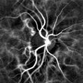 Retinal blood flow in the optic nerve head region revealed by laser Doppler imaging by digital holography